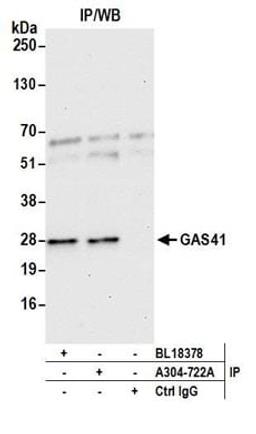 Detection of human GAS41 by western blot of immunoprecipitates.