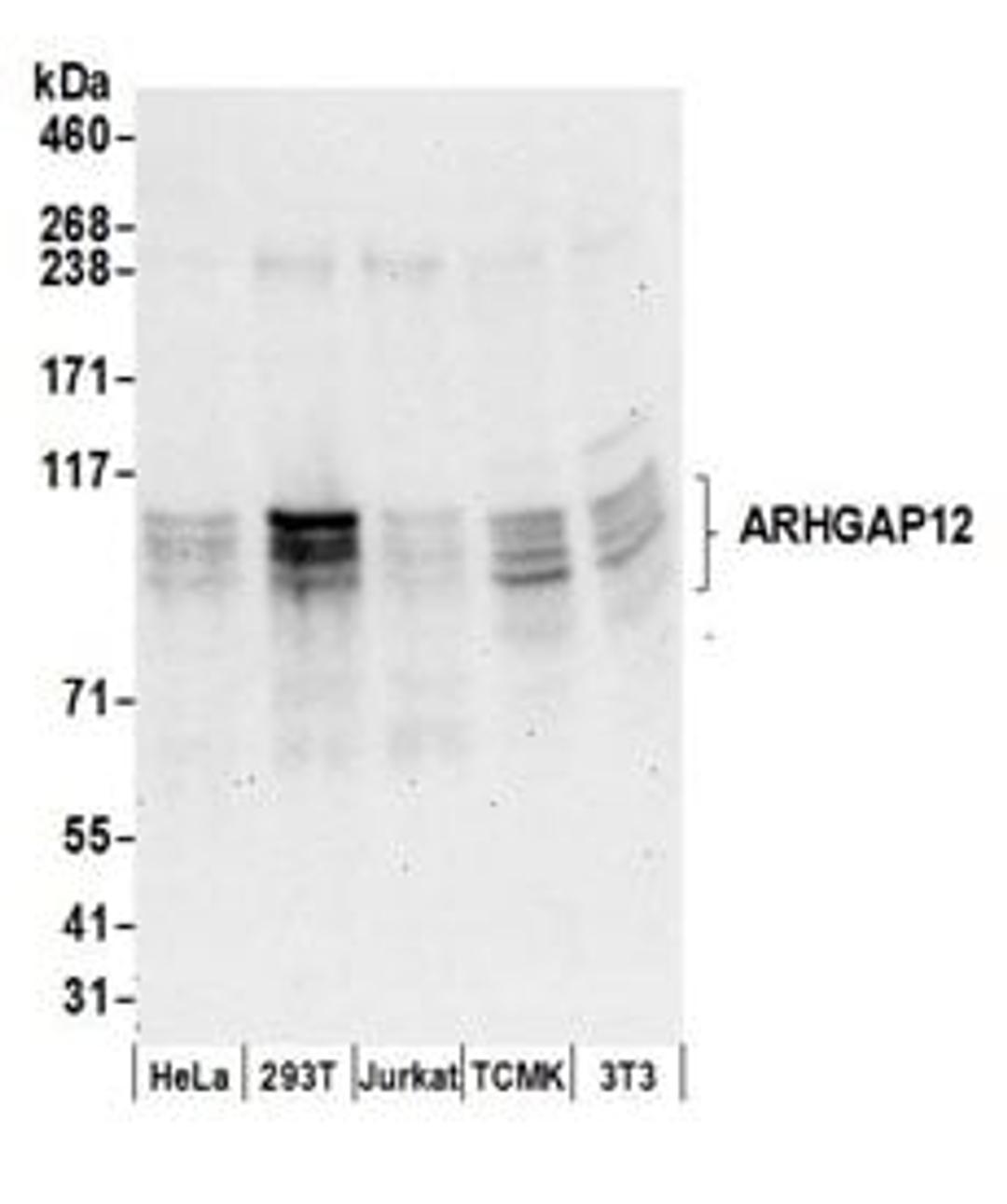 Detection of human and mouse ARHGAP12 by western blot.