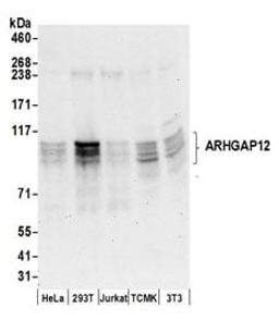 Detection of human and mouse ARHGAP12 by western blot.