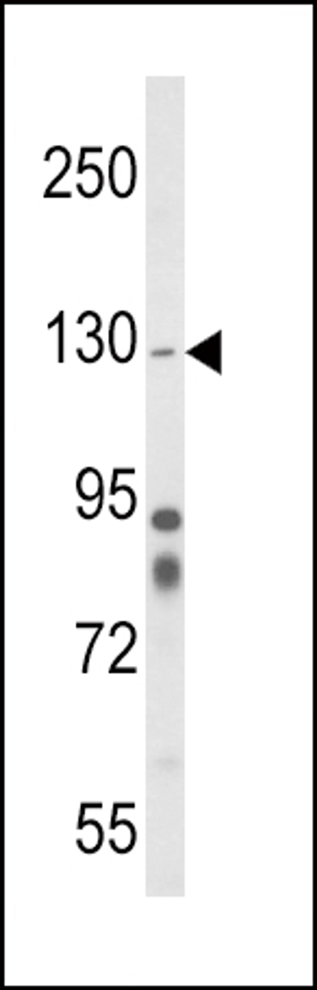 Western blot analysis of ITGA1 Antibody in mouse cerebellum tissue lysates (35ug/lane)