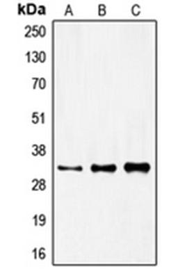 Western blot analysis of HeLa (Lane 1), mouse kidney (Lane 2), rat kidney (Lane 3) whole cell lysates using FOXR1 antibody