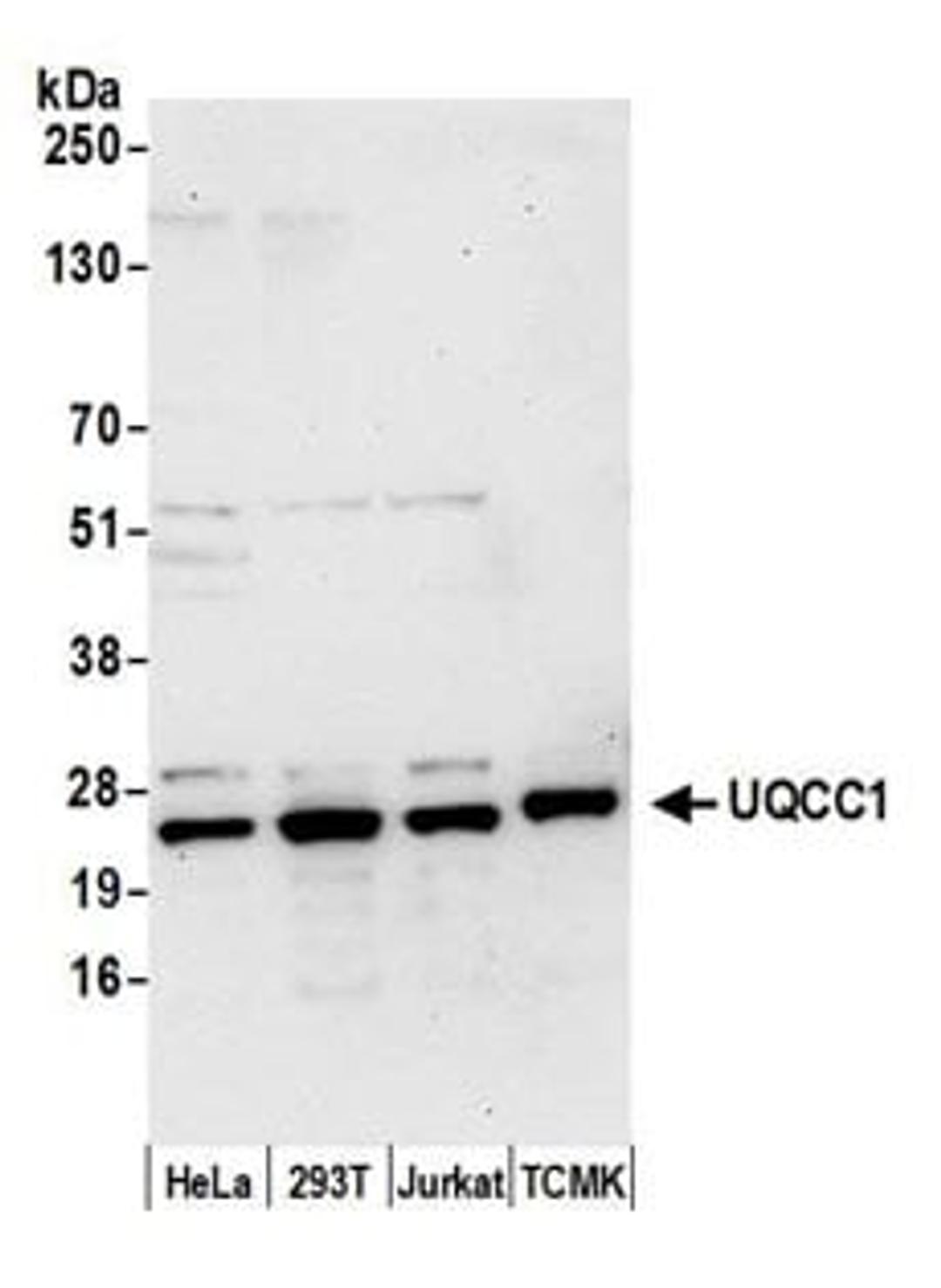 Detection of human and mouse UQCC1 by western blot.