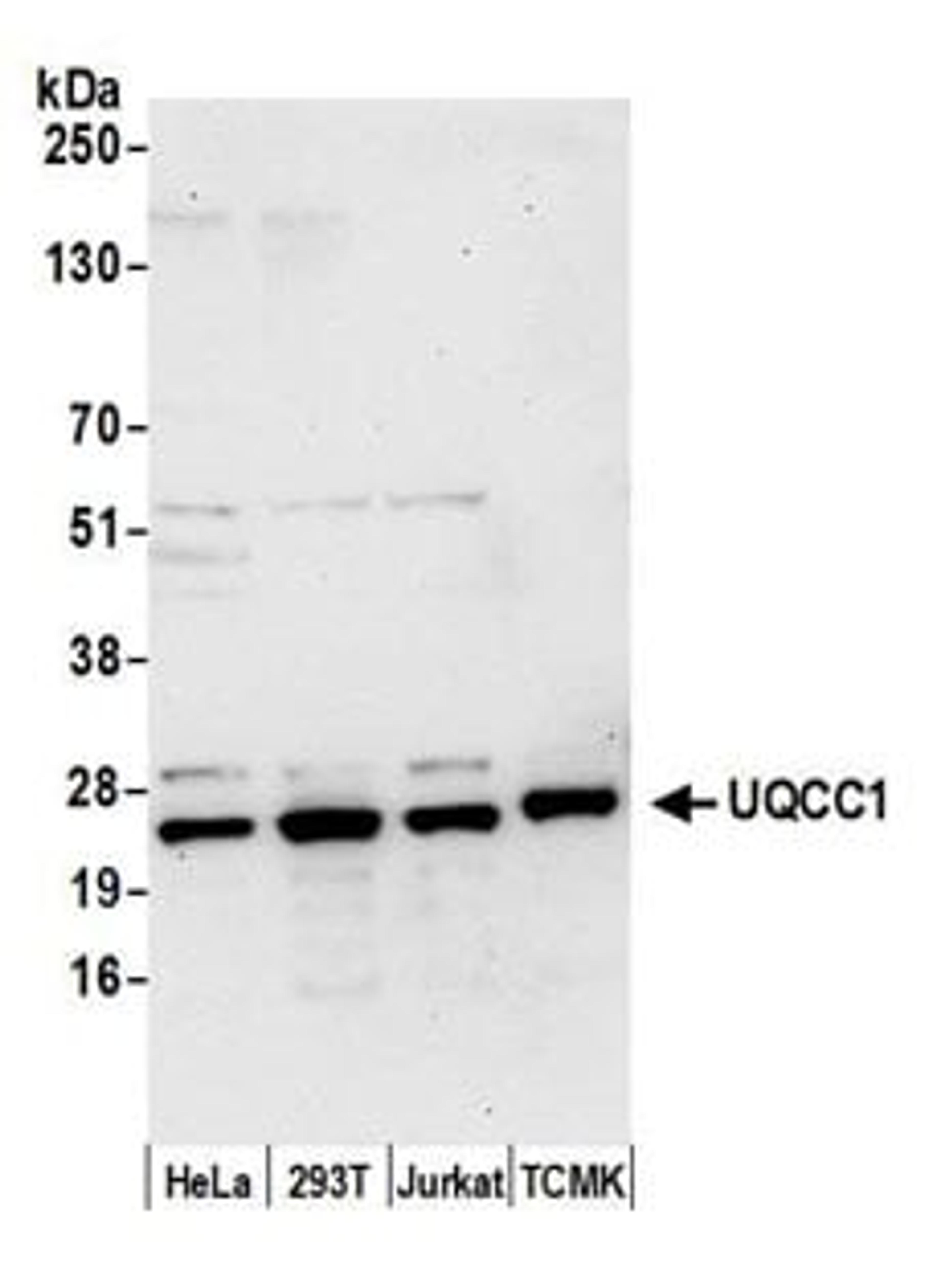 Detection of human and mouse UQCC1 by western blot.