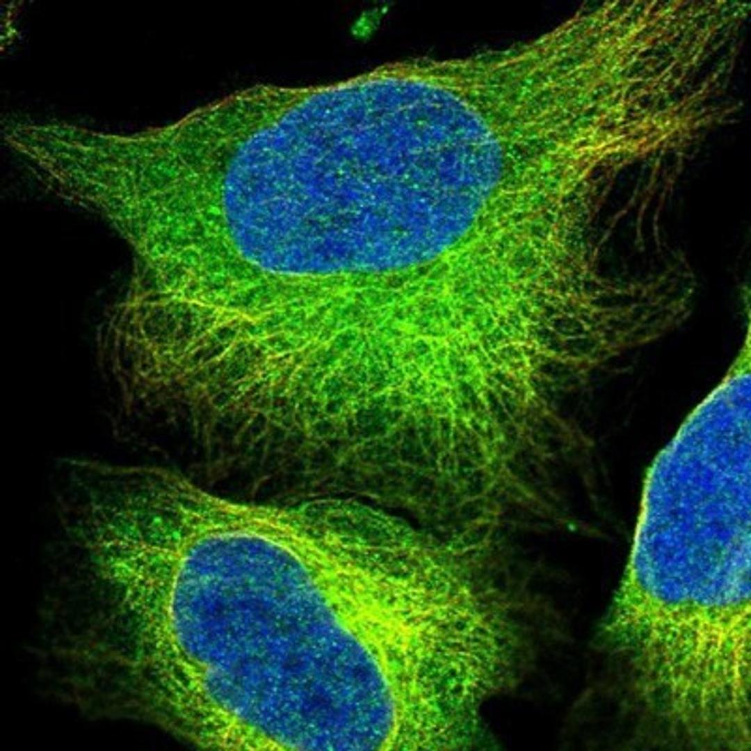 Immunocytochemistry/Immunofluorescence: TACC1 Antibody [NBP1-89447] - Staining of human cell line U-2 OS shows positivity in cytoplasm & cytoskeleton (microtubules).