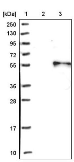 Aggregation: VEGF-D Antibody [NBP1-86865] - Lane 1: Marker [kDa] 250, 130, 95, 72, 55, 36, 28, 17, 10<br/>Lane 2: Negative control (vector only transfected HEK293T lysate)<br/>Lane 3: Over-expression lysate (Co-expressed with a C-terminal myc-DDK tag (~3.1 kDa) in mammalian HEK293T cells, LY417969)