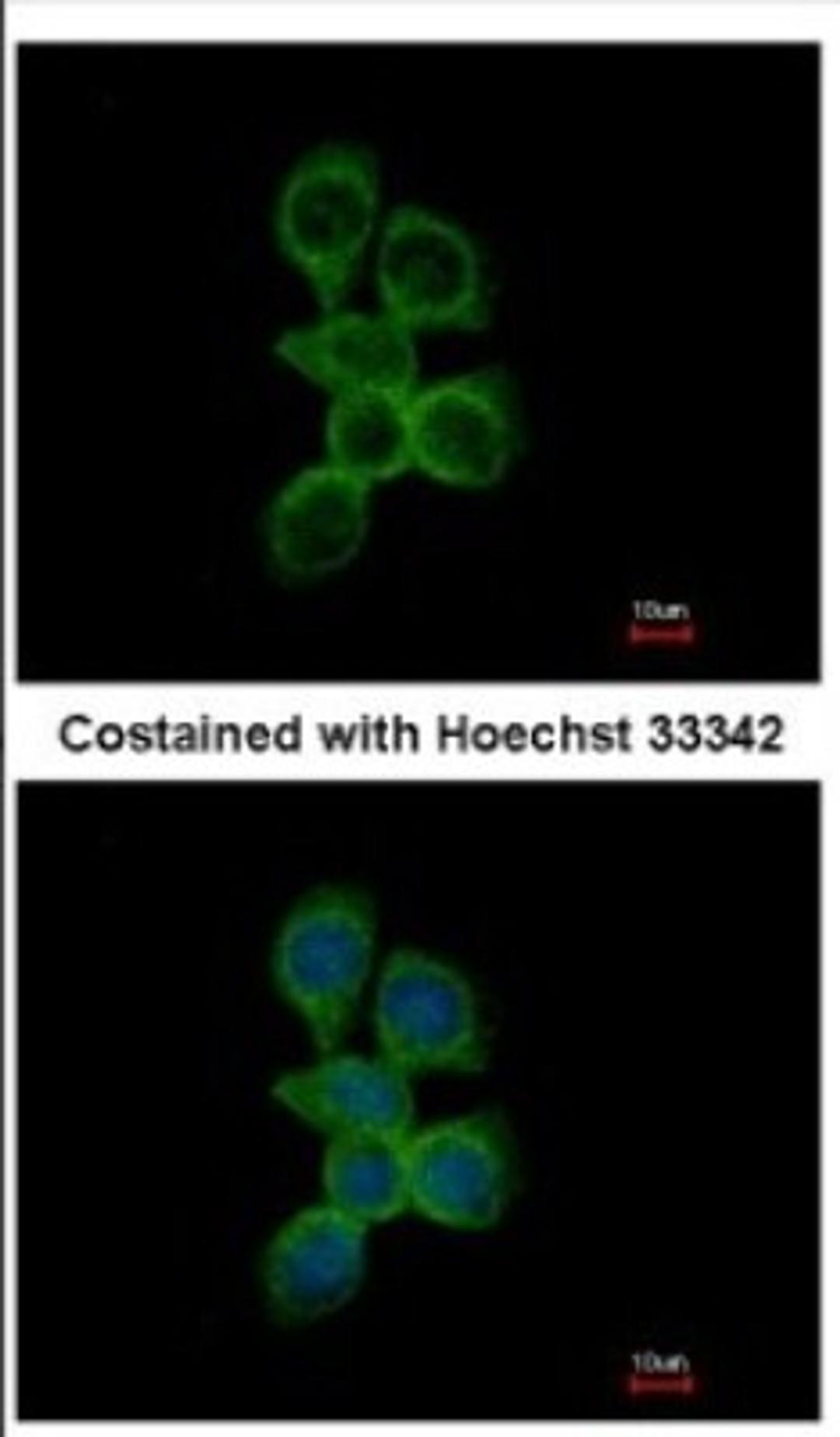 Immunocytochemistry/Immunofluorescence: OCRL Antibody [NBP2-19621] - Immunofluorescence analysis of methanol-fixed A431, using antibody at 1:500 dilution.