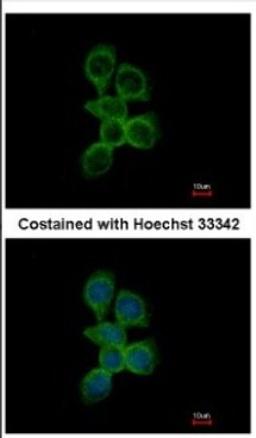 Immunocytochemistry/Immunofluorescence: OCRL Antibody [NBP2-19621] - Immunofluorescence analysis of methanol-fixed A431, using antibody at 1:500 dilution.