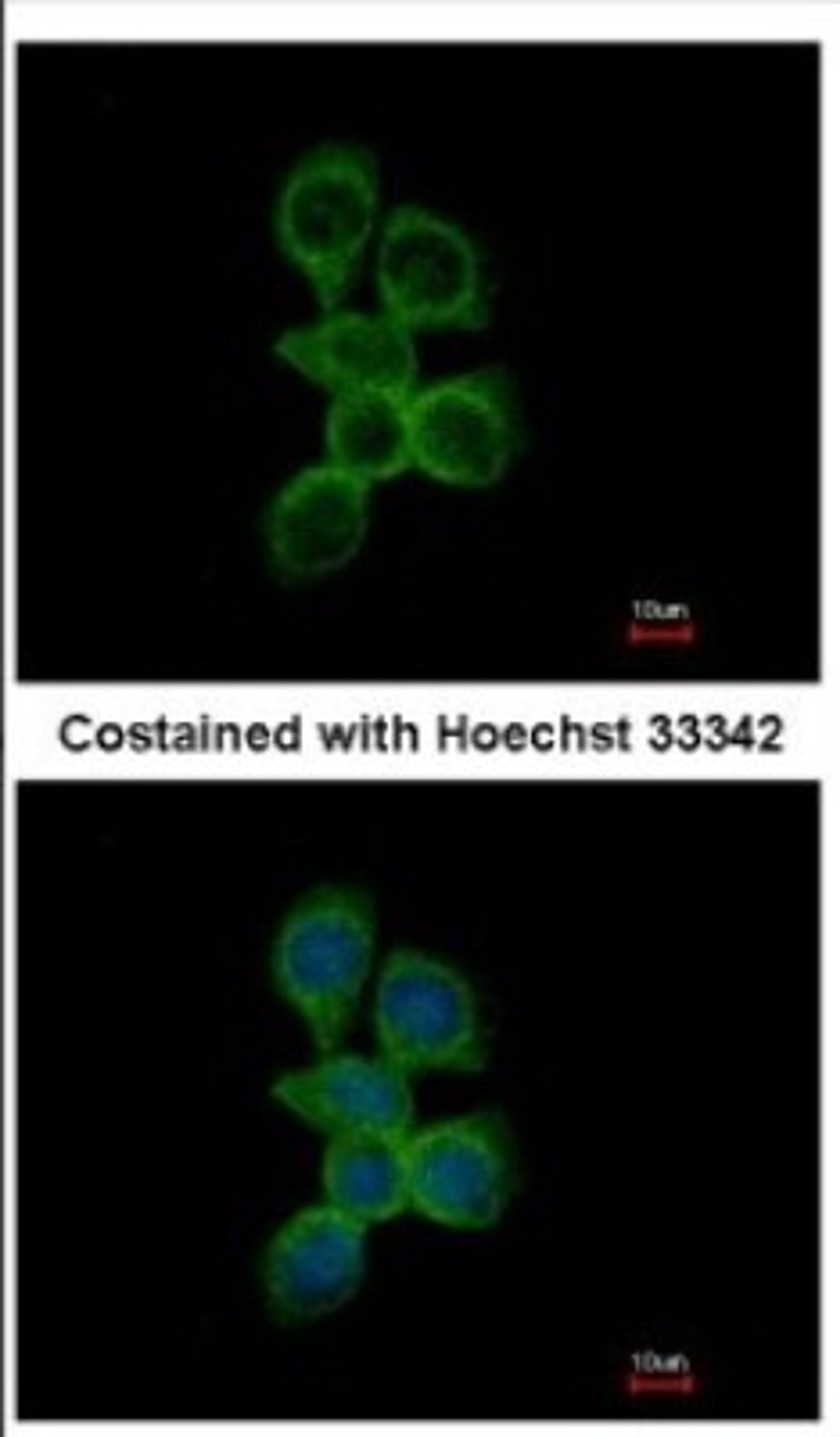 Immunocytochemistry/Immunofluorescence: OCRL Antibody [NBP2-19621] - Immunofluorescence analysis of methanol-fixed A431, using antibody at 1:500 dilution.