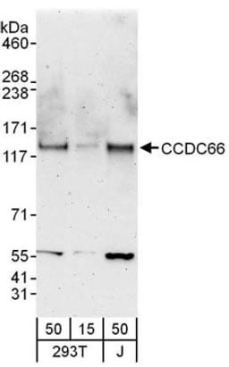 Detection of human CCDC66 by western blot.