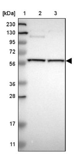 Western Blot: STK4 Antibody [NBP1-82865] - Lane 1: Marker [kDa] 230, 130, 95, 72, 56, 36, 28, 17, 11<br/>Lane 2: Human cell line RT-4<br/>Lane 3: Human cell line U-251MG sp