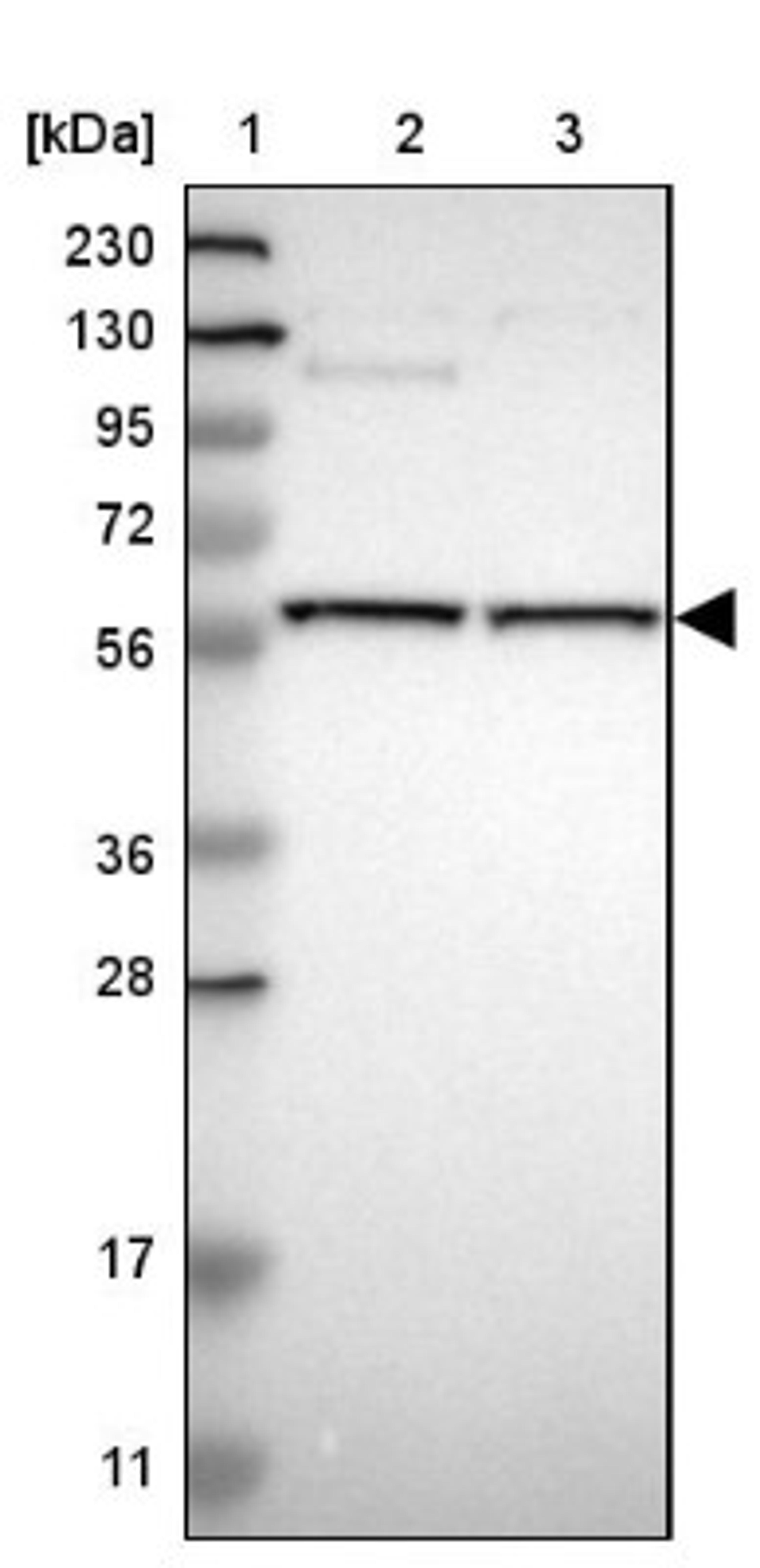 Western Blot: STK4 Antibody [NBP1-82865] - Lane 1: Marker [kDa] 230, 130, 95, 72, 56, 36, 28, 17, 11<br/>Lane 2: Human cell line RT-4<br/>Lane 3: Human cell line U-251MG sp