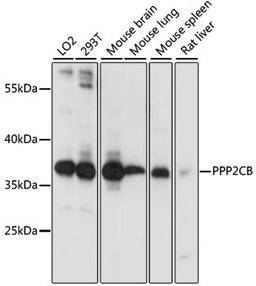 Western blot - PPP2CB antibody (A3122)