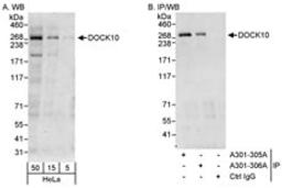 Detection of human DOCK10 by western blot and immunoprecipitation.