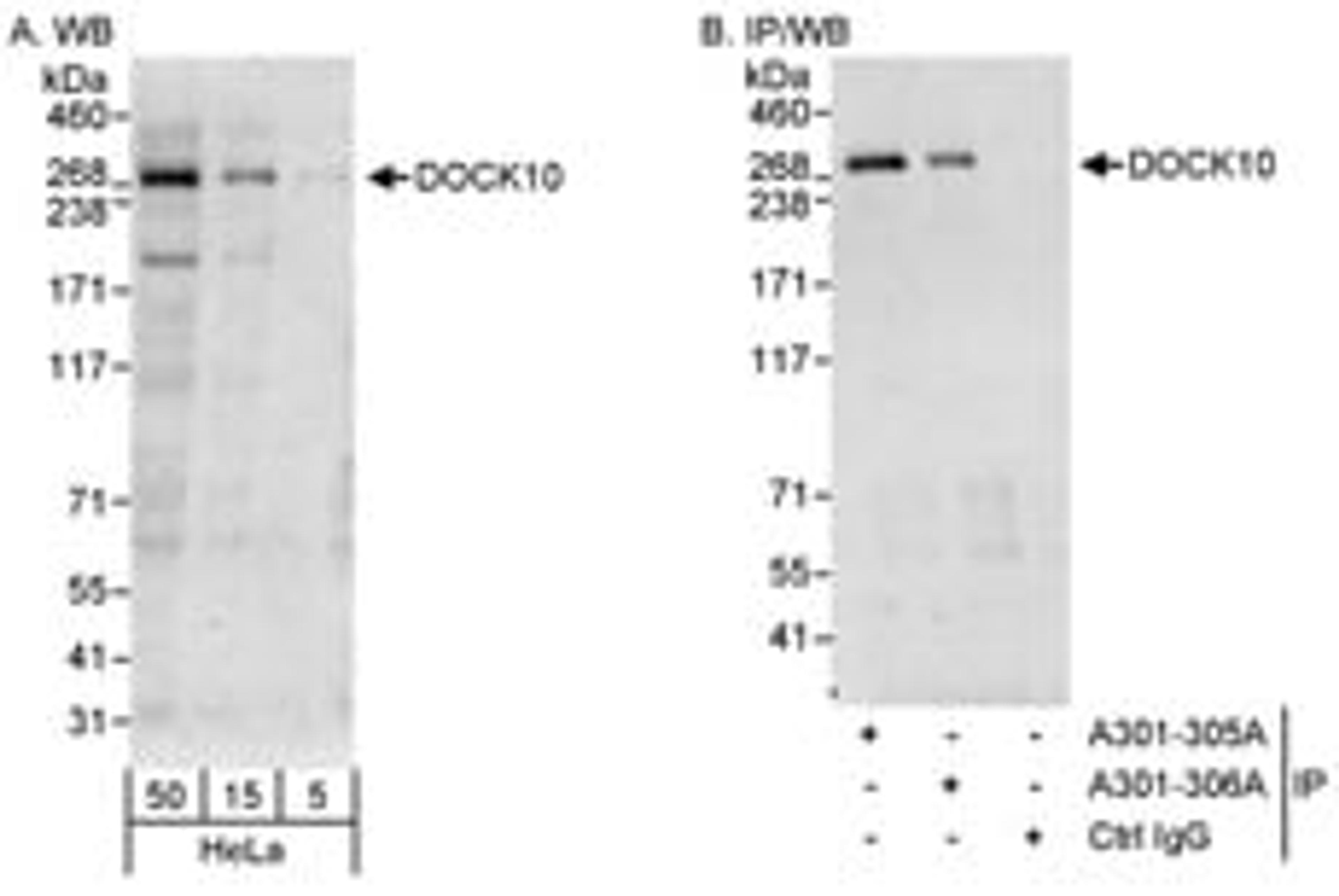 Detection of human DOCK10 by western blot and immunoprecipitation.