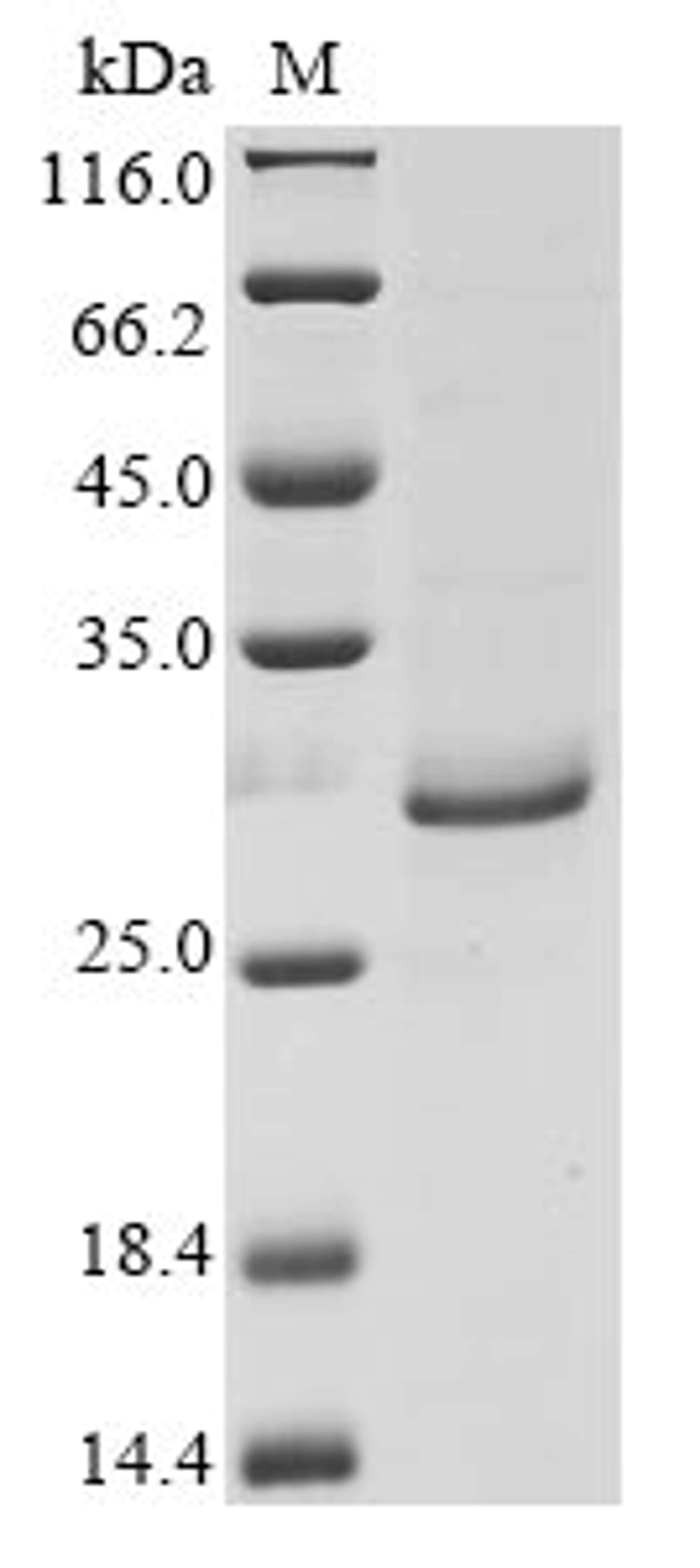 (Tris-Glycine gel) Discontinuous SDS-PAGE (reduced) with 5% enrichment gel and 15% separation gel.