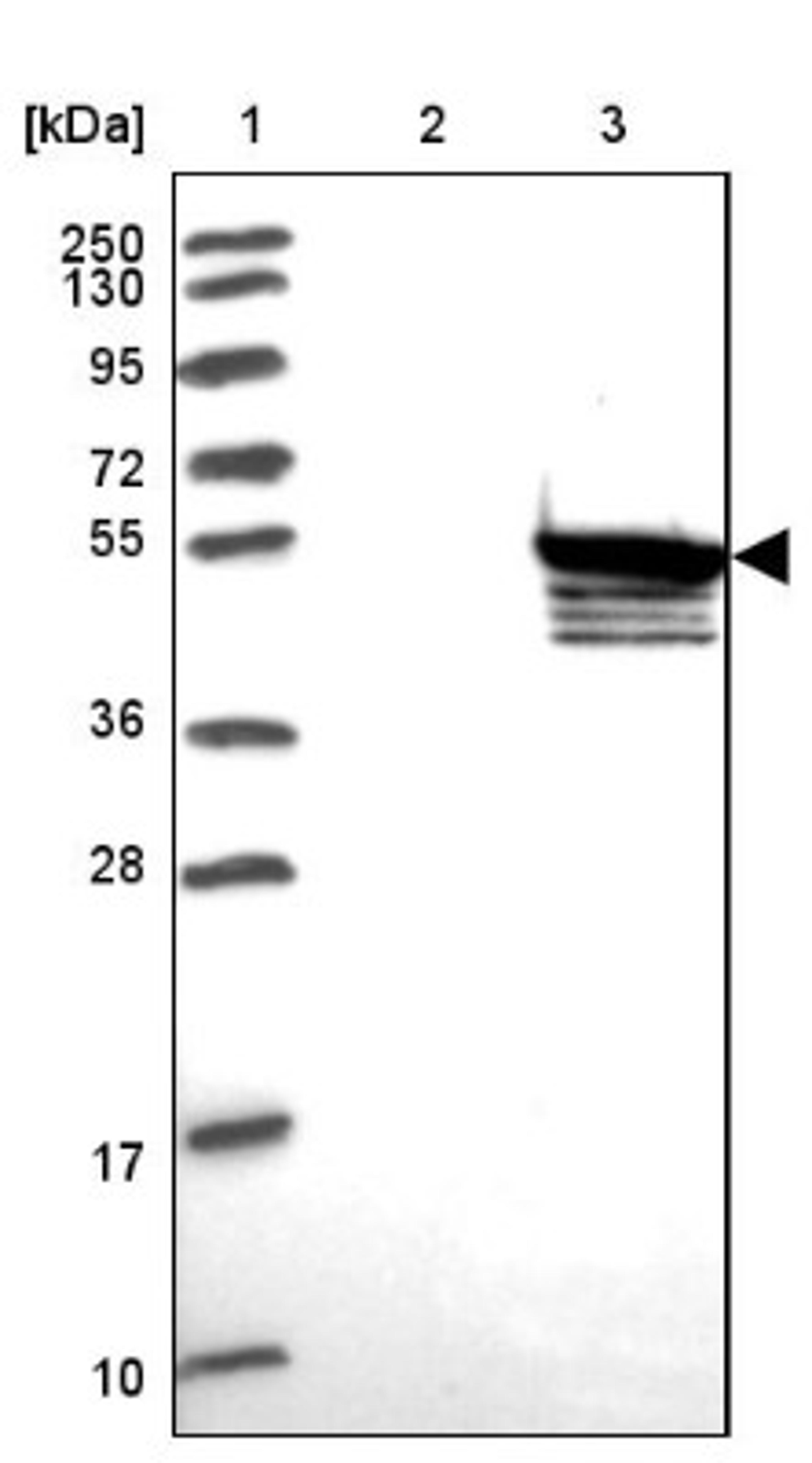 Western Blot: SUHW3 Antibody [NBP2-33618] - Lane 1: Marker [kDa] 250, 130, 95, 72, 55, 36, 28, 17, 10<br/>Lane 2: Human cell line RT-4<br/>Lane 3: Human cell line U-251MG sp