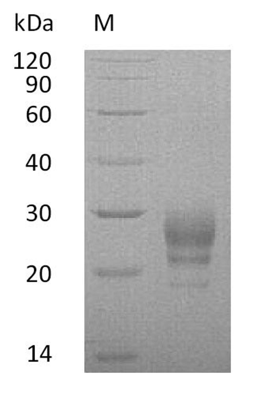(Tris-Glycine gel) Discontinuous SDS-PAGE (reduced) with 5% enrichment gel and 15% separation gel.
