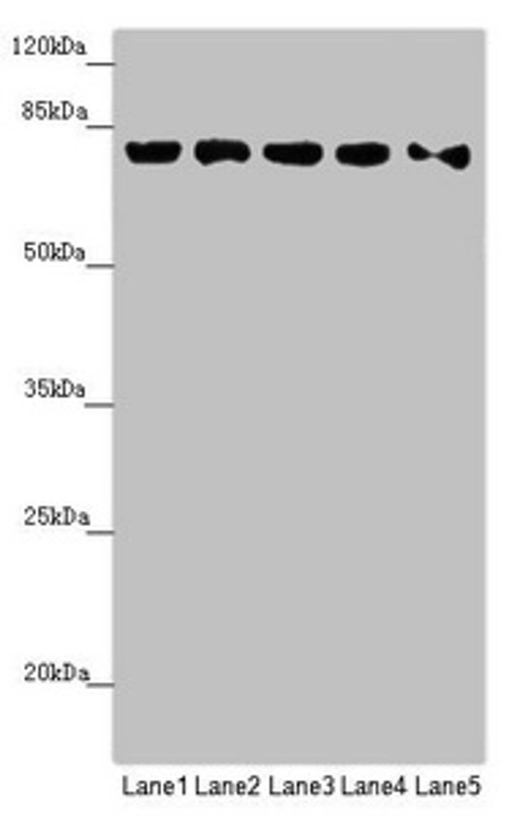 Western blot. All lanes: MCCC1 antibody at 0.89µg/ml. Lane 1: HepG2 whole cell lysate. Lane 2: 293T whole cell lysate. Lane 3: Hela whole cell lysate. Lane 4: MCF-7 whole cell lysate. Lane 5: A549 whole cell lysate. Secondary. Goat polyclonal to rabbit IgG at 1/10000 dilution. Predicted band size: 81 kDa. Observed band size: 81 kDa