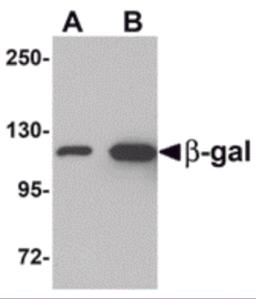 Western blot analysis of (A) 5 and (B) 25 ng of b-gal with b-gal antibody at 1 &#956;g/mL.