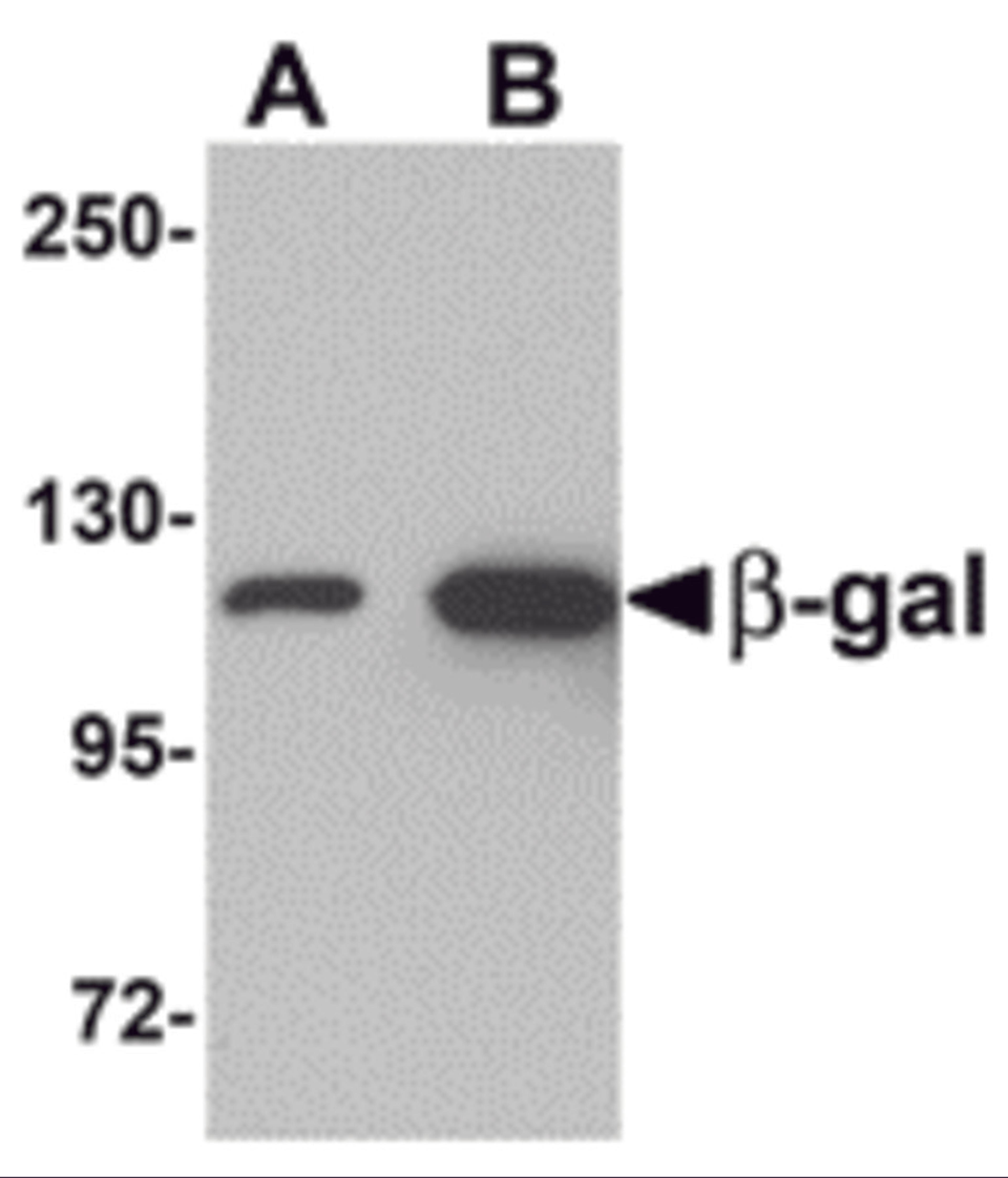 Western blot analysis of (A) 5 and (B) 25 ng of b-gal with b-gal antibody at 1 &#956;g/mL.