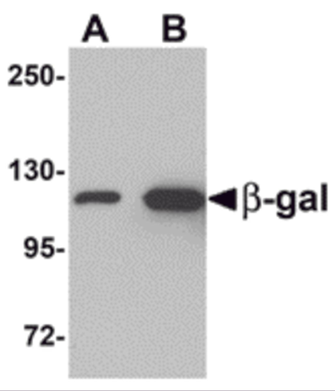 Western blot analysis of (A) 5 and (B) 25 ng of b-gal with b-gal antibody at 1 μg/mL.