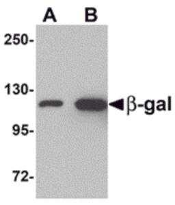 Western blot analysis of (A) 5 and (B) 25 ng of b-gal with b-gal antibody at 1 μg/mL.