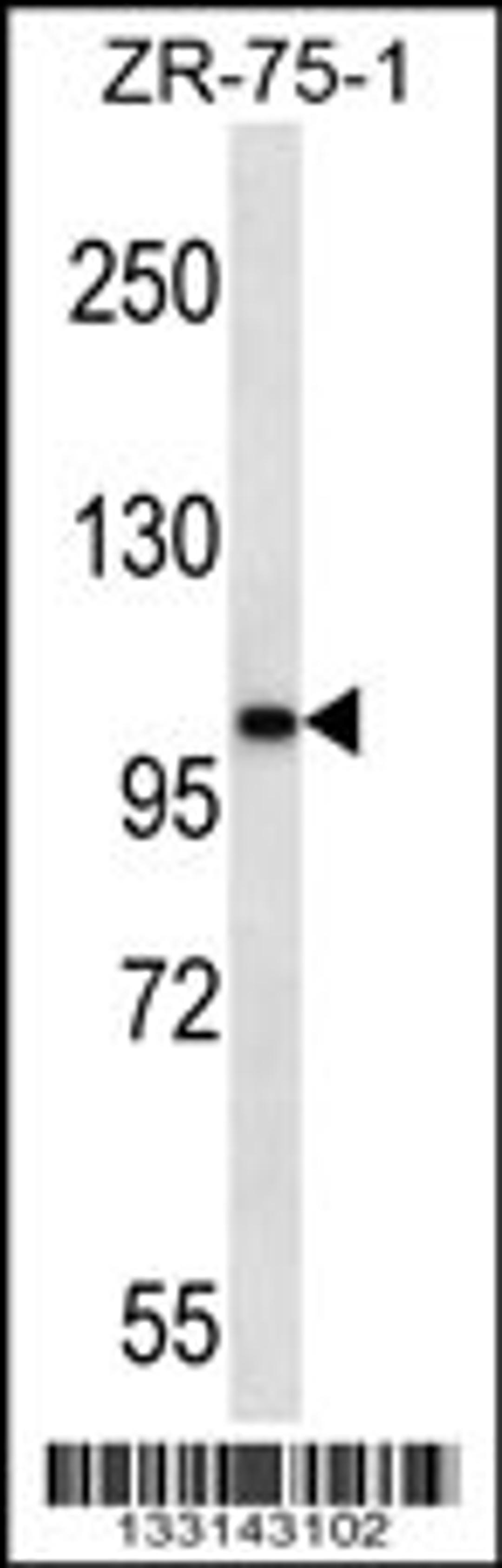 Western blot analysis in ZR-75-1 cell line lysates (35ug/lane).This demonstrates the detected the AR protein (arrow).