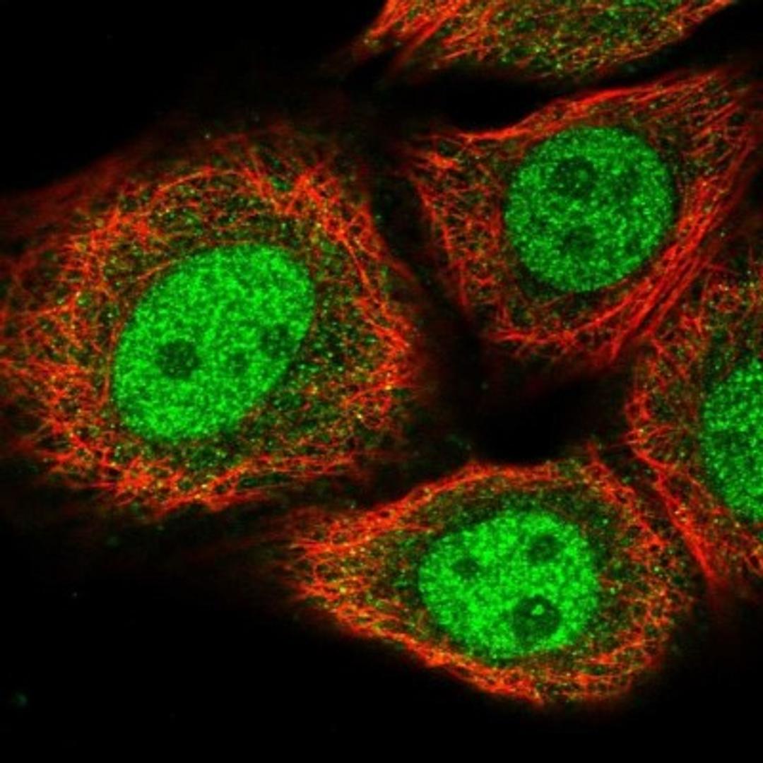 Immunocytochemistry/Immunofluorescence: BRMS1L Antibody [NBP2-14362] - Staining of human cell line MCF-7 shows positivity in nucleus but not nucleoli.