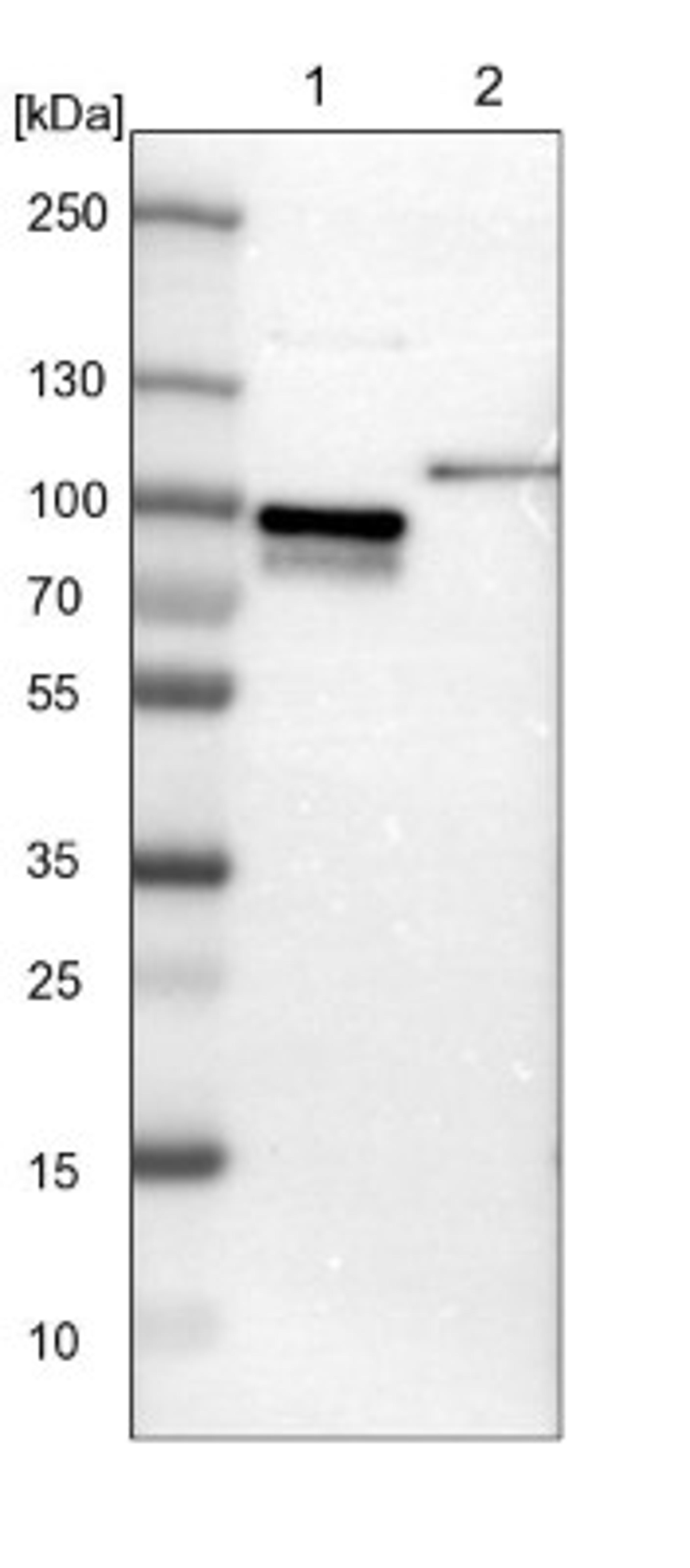 Western Blot: CIN85/SH3KBP1 Antibody [NBP1-85614] - Lane 1: NIH-3T3 cell lysate (Mouse embryonic fibroblast cells)<br/>Lane 2: NBT-II cell lysate (Rat Wistar bladder tumour cells)