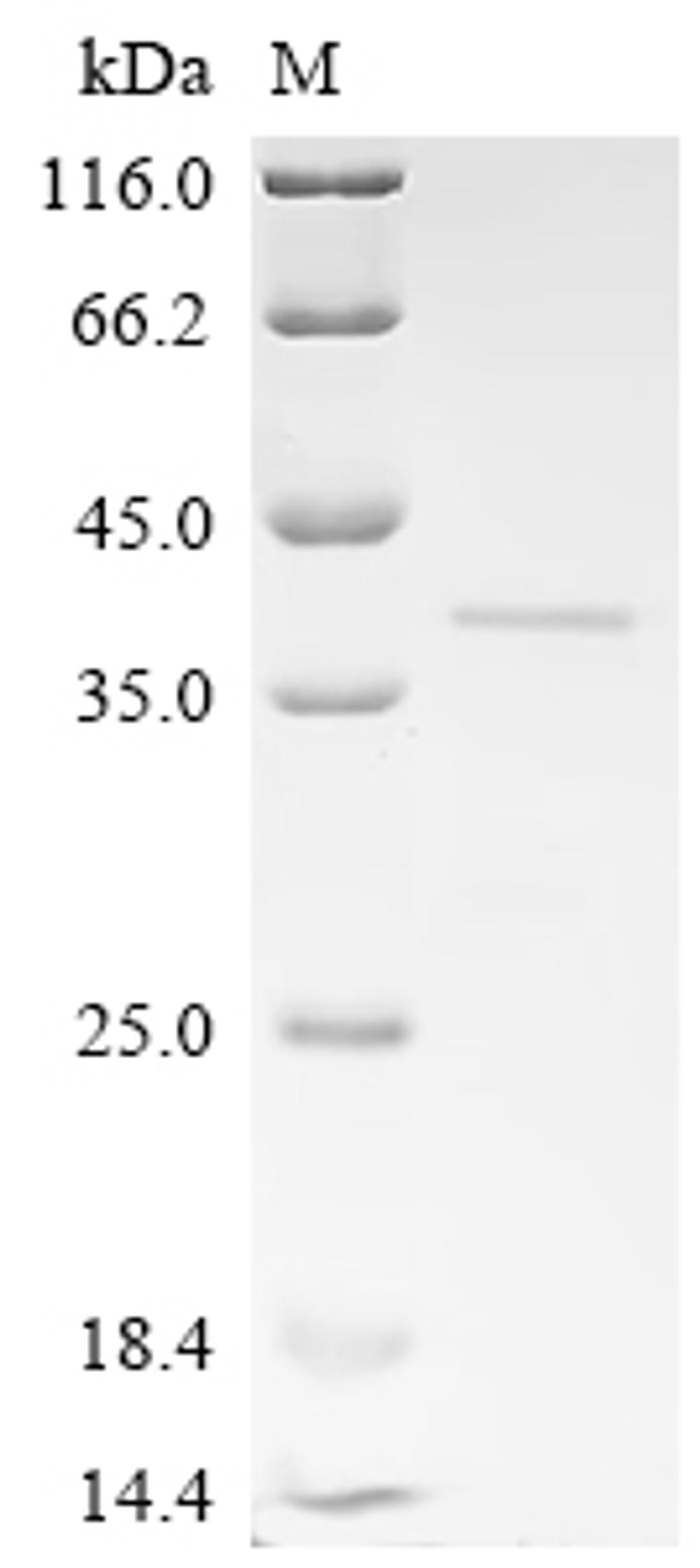 (Tris-Glycine gel) Discontinuous SDS-PAGE (reduced) with 5% enrichment gel and 15% separation gel.