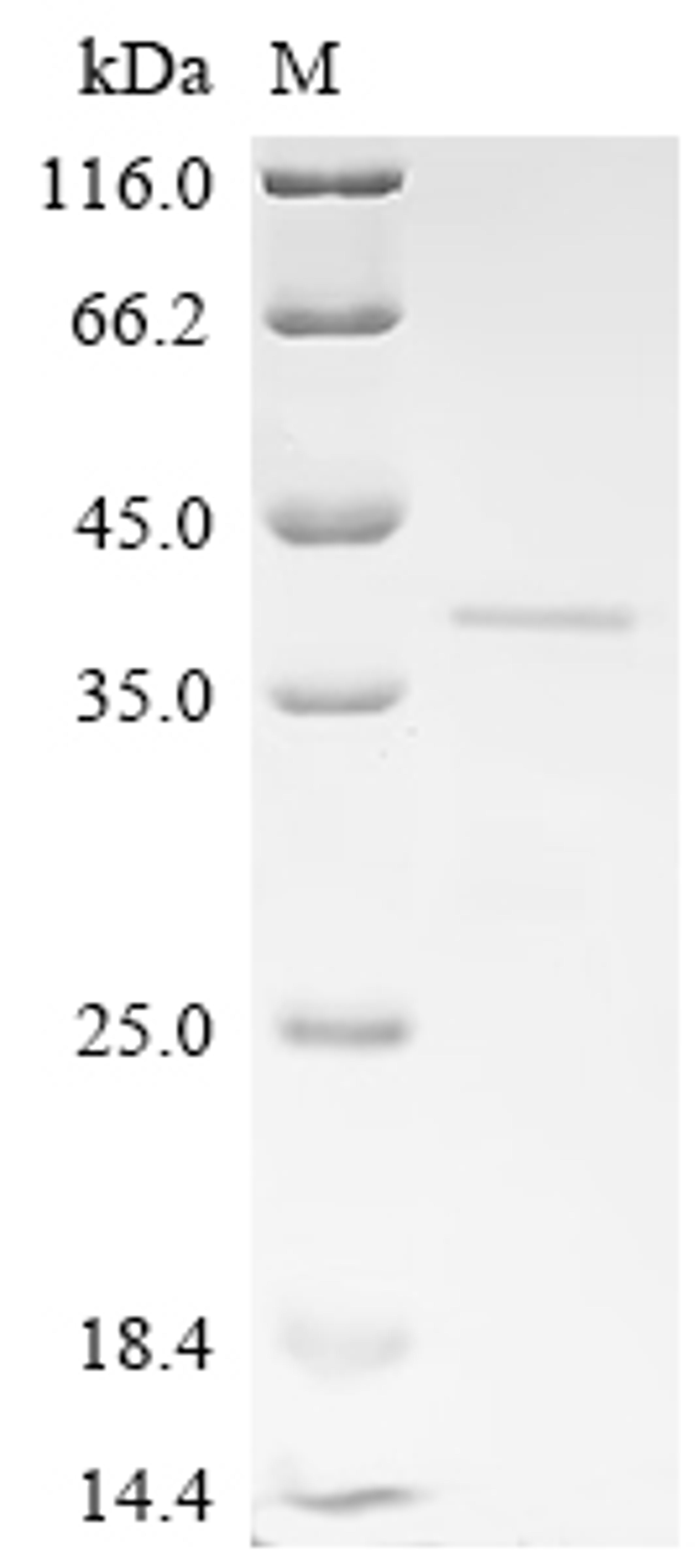 (Tris-Glycine gel) Discontinuous SDS-PAGE (reduced) with 5% enrichment gel and 15% separation gel.