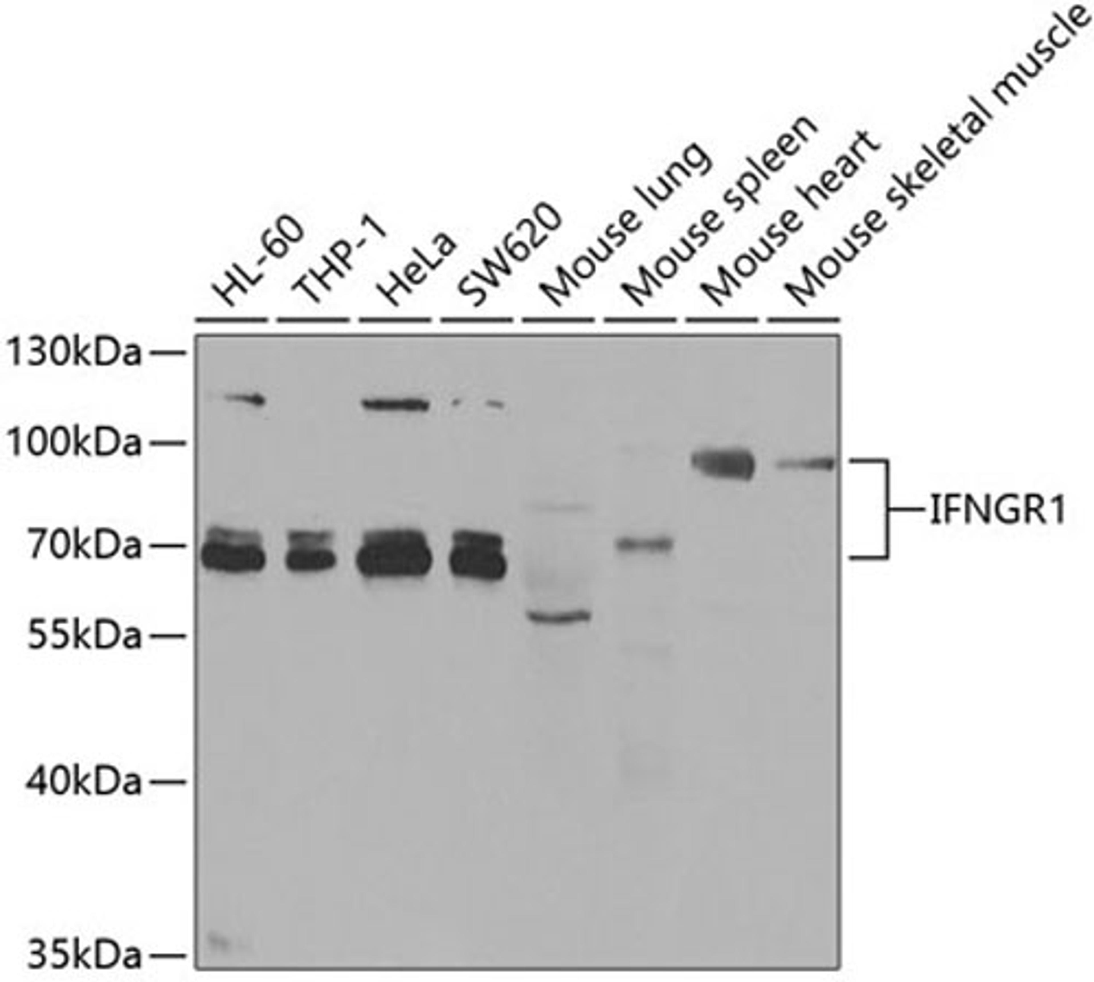 Western blot - IFNGR1 antibody (A5748)