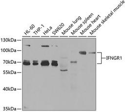Western blot - IFNGR1 antibody (A5748)