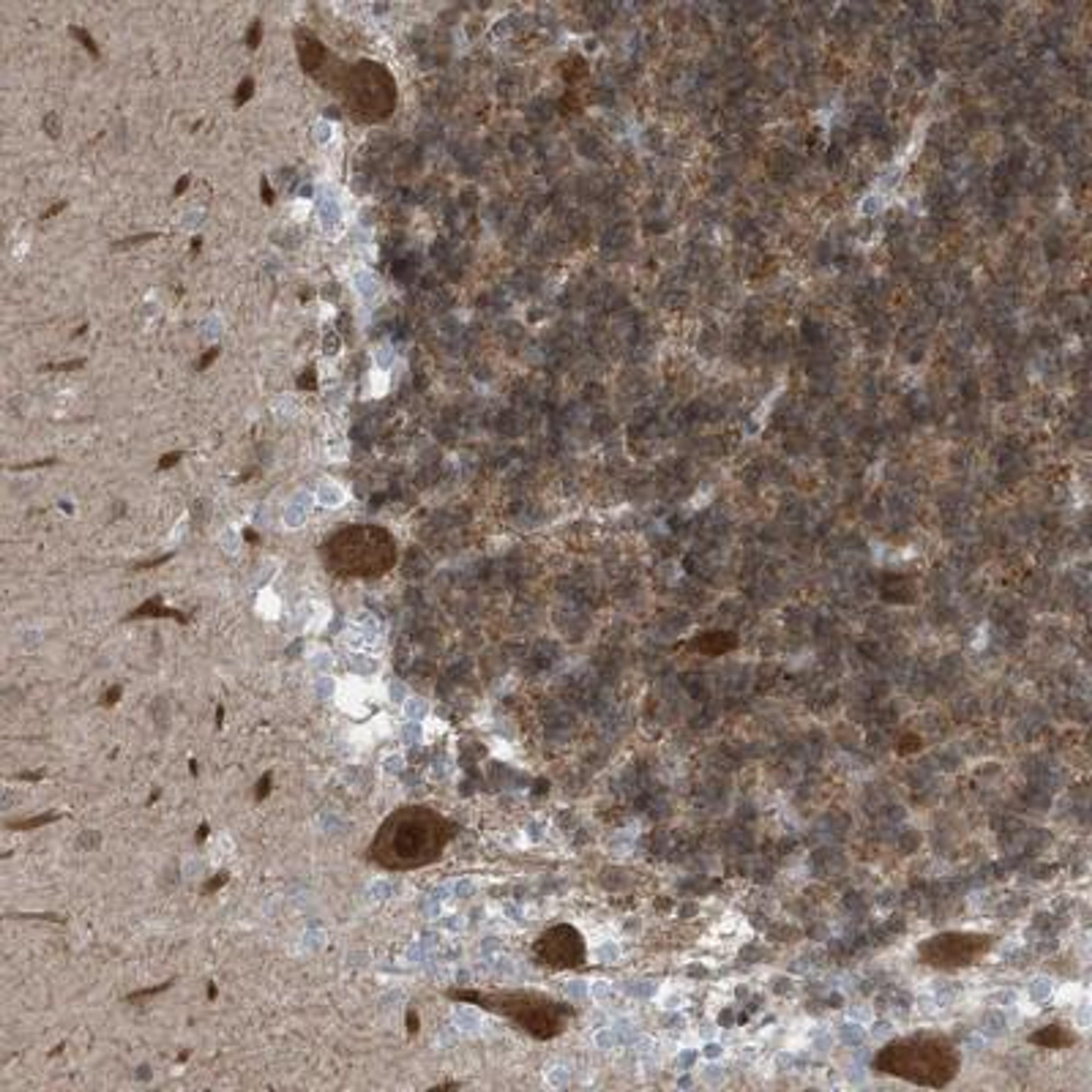 Immunohistochemistry: NCOA7 Antibody [NBP1-85200] - Staining of human cerebellum shows strong cytoplasmic and nuclear positivity in Purkinje cells.