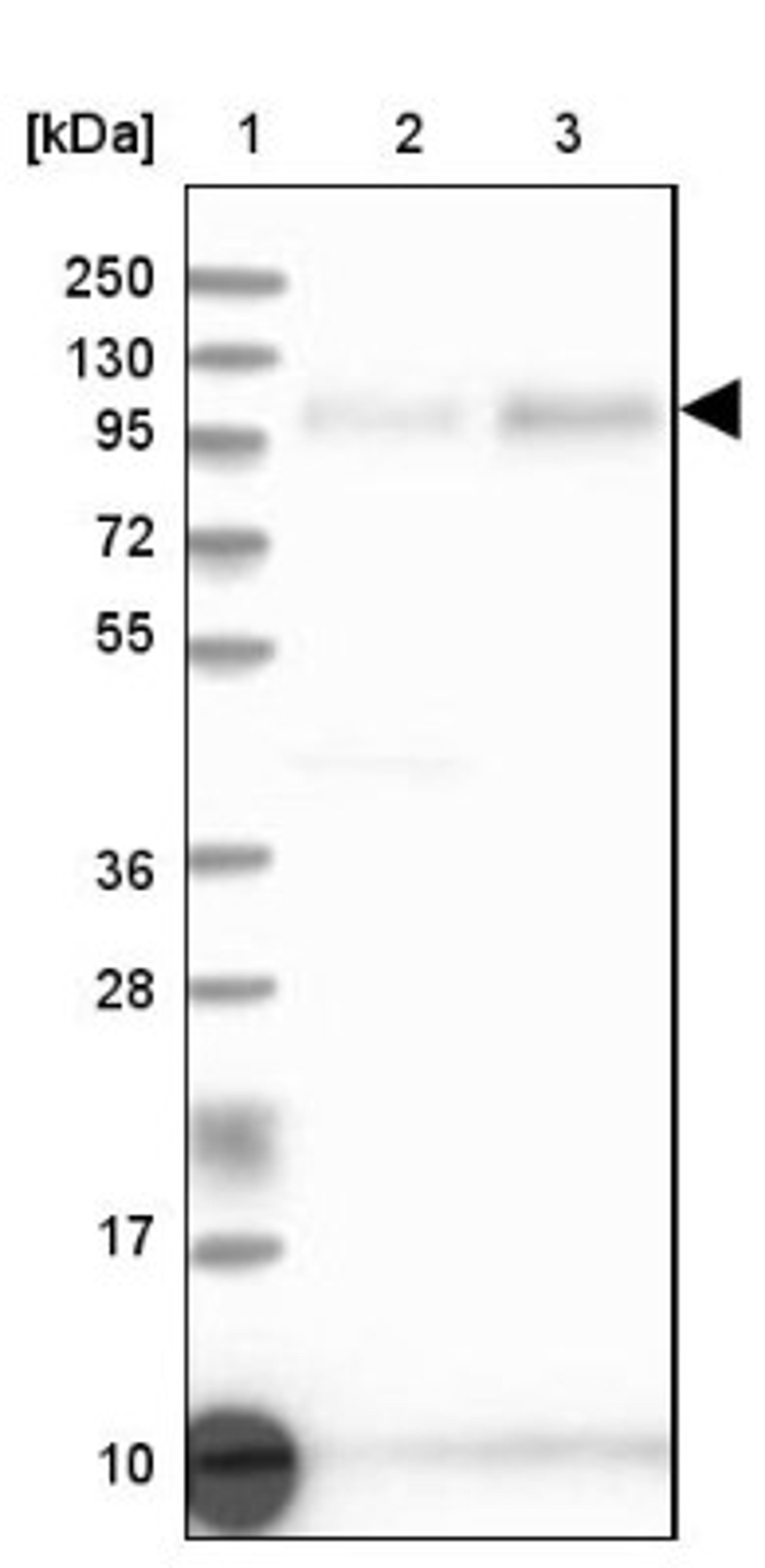 Western Blot: QRICH1 Antibody [NBP2-32693] - Lane 1: Marker [kDa] 250, 130, 95, 72, 55, 36, 28, 17, 10<br/>Lane 2: Human cell line RT-4<br/>Lane 3: Human cell line U-251MG sp