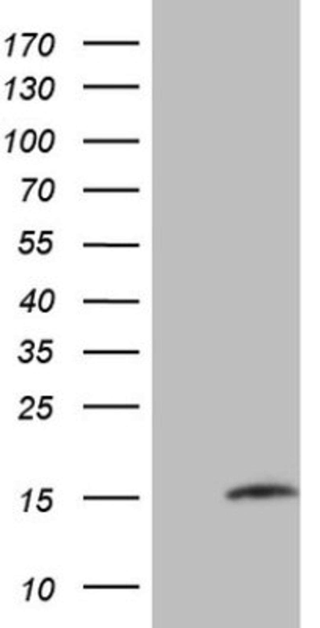 Western Blot: MGP Antibody (11G6) [NBP2-45844] - Analysis of HEK293T cells were transfected with the pCMV6-ENTRY control (Left lane) or pCMV6-ENTRY MGP.