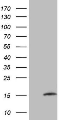 Western Blot: MGP Antibody (11G6) [NBP2-45844] - Analysis of HEK293T cells were transfected with the pCMV6-ENTRY control (Left lane) or pCMV6-ENTRY MGP.