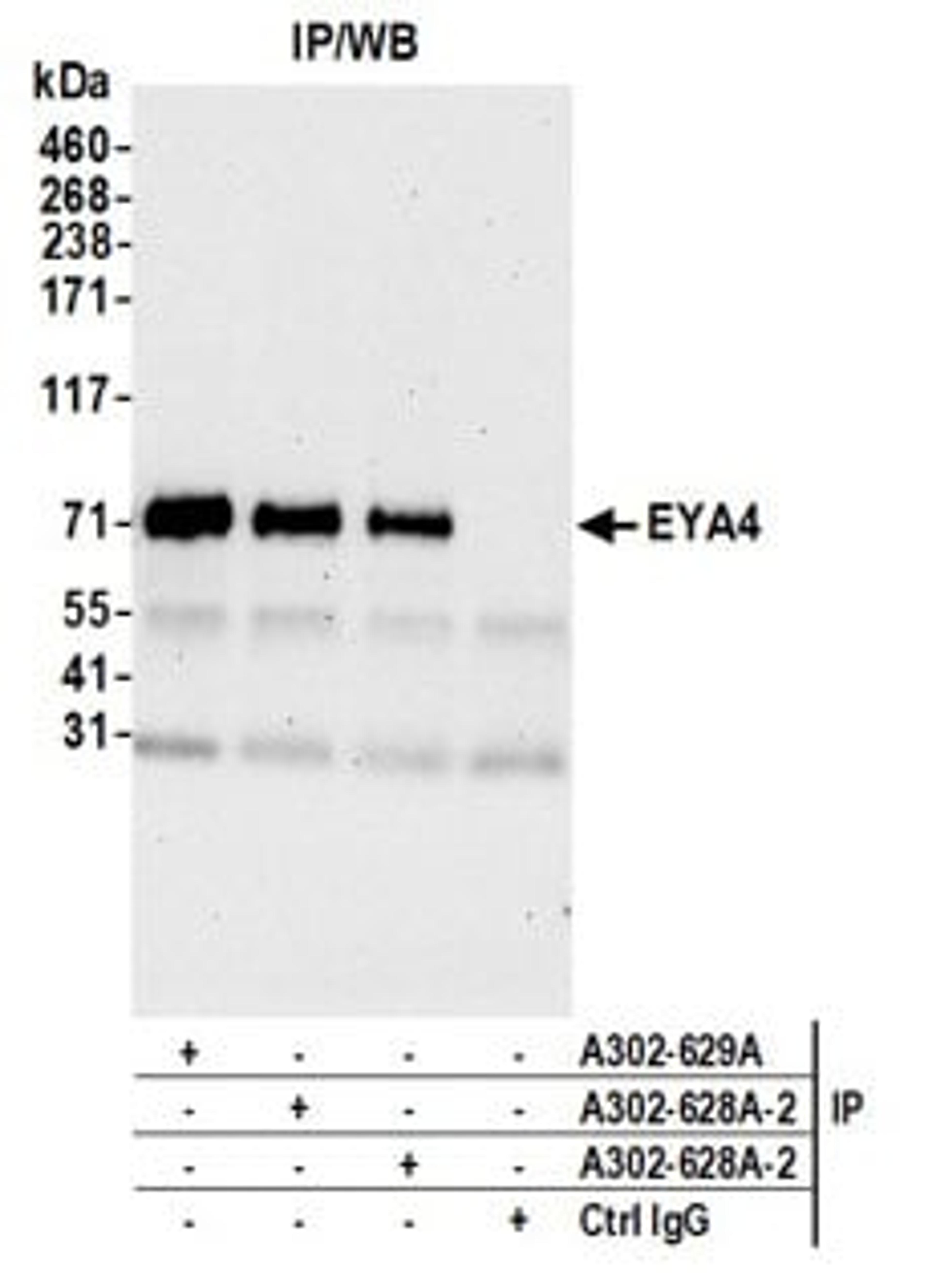 Detection of human EYA4 by western blot of immunoprecipitates.