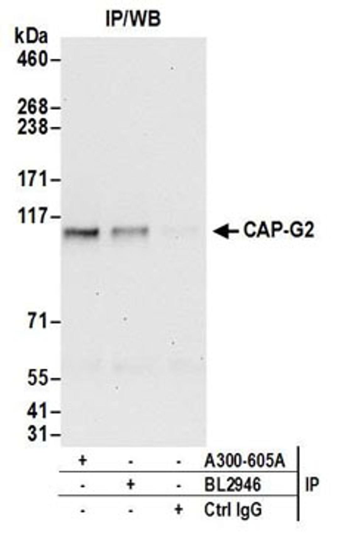 Detection of human CAP-G2 by western blot of immunoprecipitates.