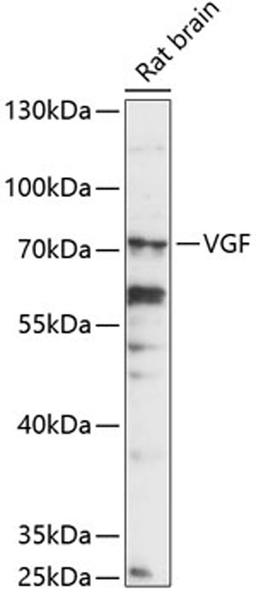 Western blot - VGF antibody (A14795)