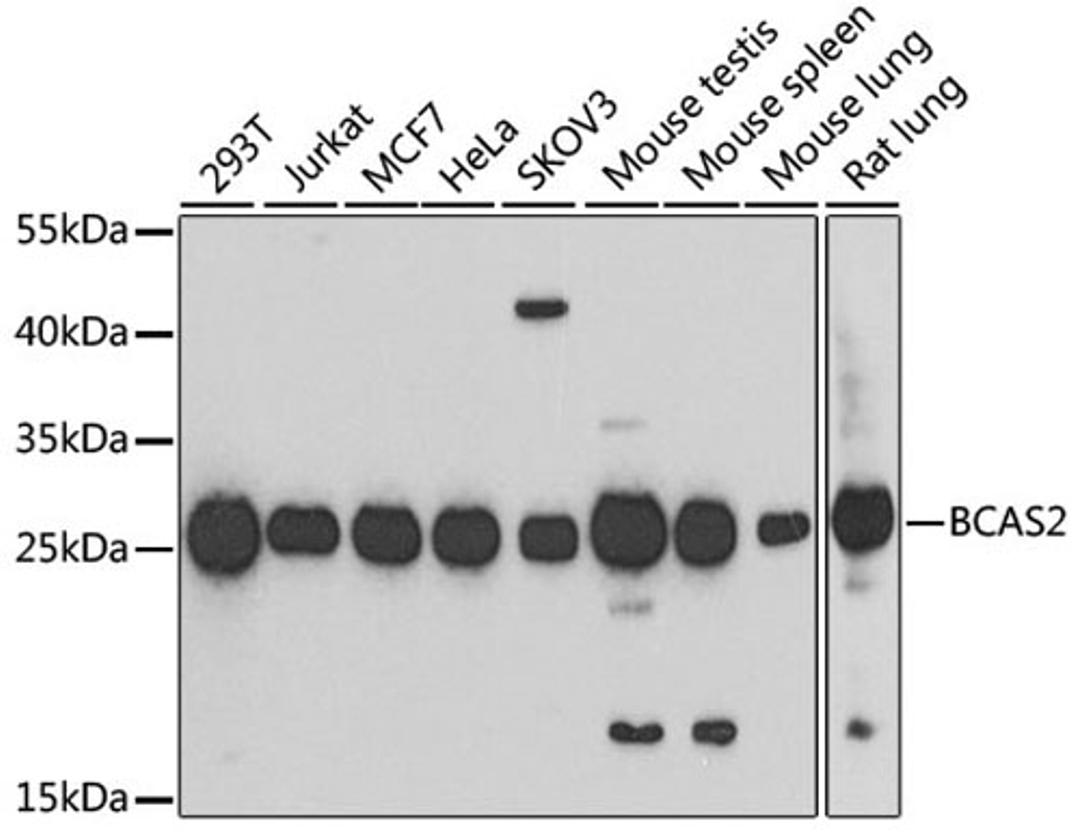 Western blot - BCAS2 antibody (A4398)