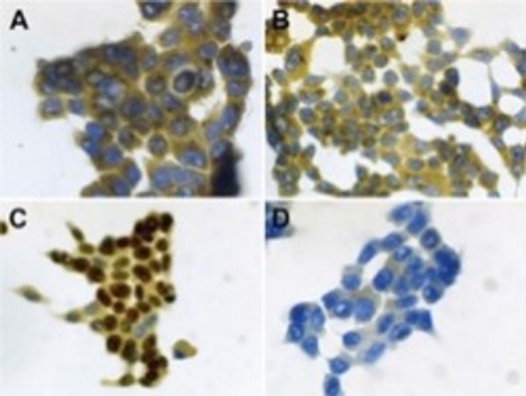 Immunocytochemistry/Immunofluorescence: Psoriasin/S100A7 Antibody (47C1068) [Azide Free] [NBP2-24911] - Psoriasin (HID5/S100A7) immunocytochemical detection was performed on (A) untreated and (B) LPS-treated (100 ng/ml, 21 hrs) HOPE-fixed human bronchial epithelial (NCI-H727) cells. (D) Negative control was included omitting the primary antibody.