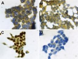 Immunocytochemistry/Immunofluorescence: S100A7/Psoriasin Antibody (47C1068) [NB100-56559] - Psoriasin/HID5/S100A7 immunocytochemical detection was performed on (A) untreated and (B) LPS-treated (100 ng/ml, 21 hrs) HOPE-fixed human bronchial epithelial (NCI-H727) cells. (D) Negative control was included omitting the primary antibody.