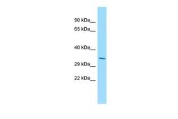 Antibody used in WB on Human Fetal Lung at 1 ug/ml.