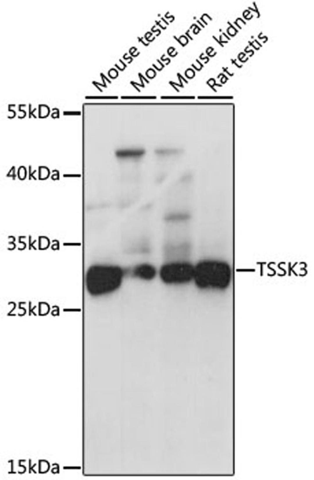 Western blot - TSSK3 antibody (A7605)