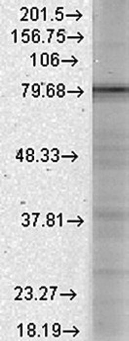 Western blot analysis of rat brain membranes using CaVbeta1 antibody