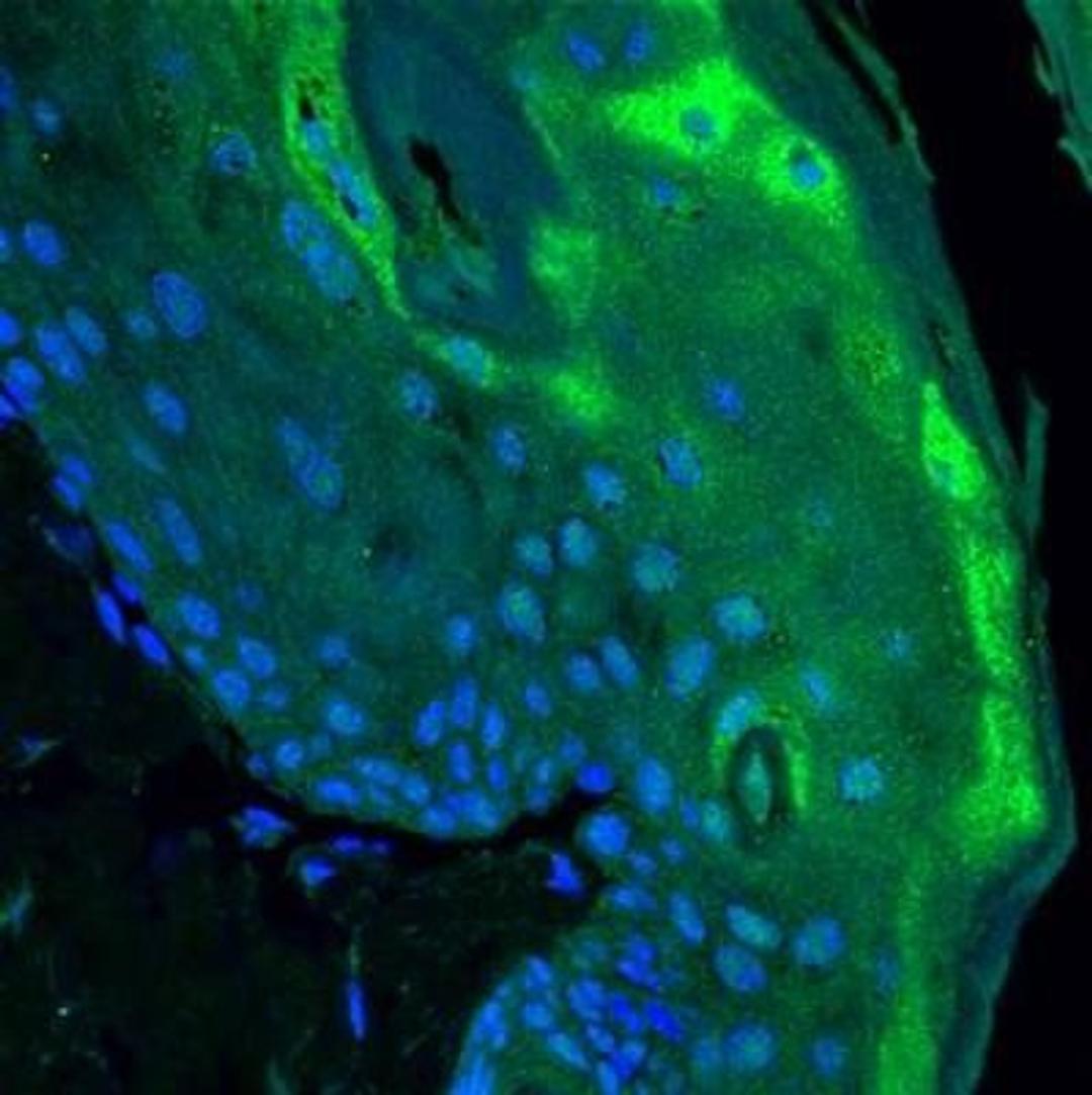 Immunocytochemistry/Immunofluorescence: B7-H1/PD-L1/CD274 Antibody (MIH5) [NBP1-43262] - Analysis using the DyLight 488 conjugate of NBP1-43262. Staining of PD-L1 in mouse tissue using anti-PD-L1 antibody. Image from verified customer review.