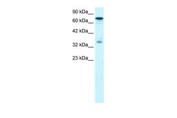 Antibody used in WB on Human HepG2 at 1.25 ug/ml.