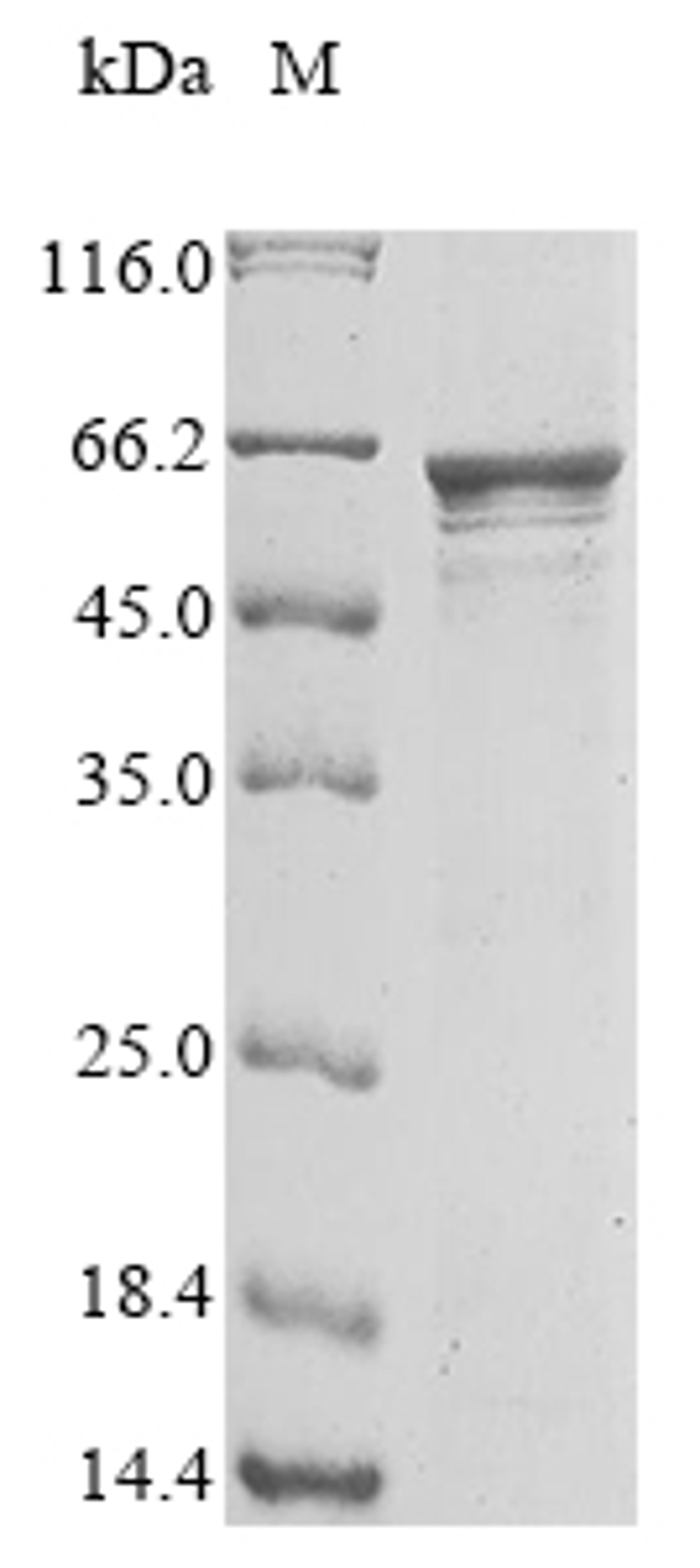 (Tris-Glycine gel) Discontinuous SDS-PAGE (reduced) with 5% enrichment gel and 15% separation gel.