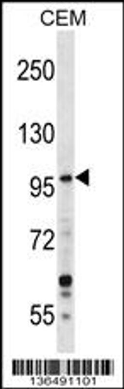 Western blot analysis in CEM cell line lysates (35ug/lane).